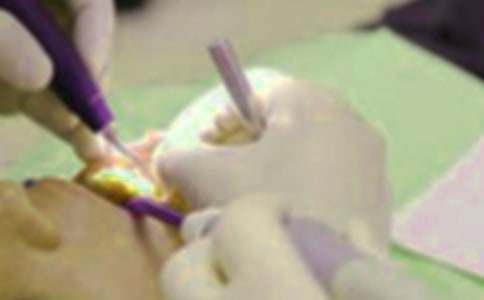 女人梦见自己用手拔牙什么意思