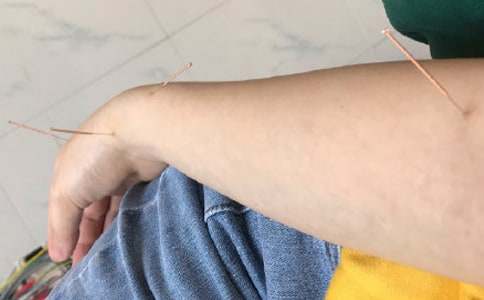 中医针灸推拿年终个人总结